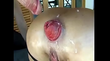Porn – Bizarre Milf Moms Hardcore Anal Fisting Prolapse Porn – Bizarre Milf Moms Hardcore Anal Fisting Prolapse