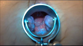 Speculum Play 8 Min